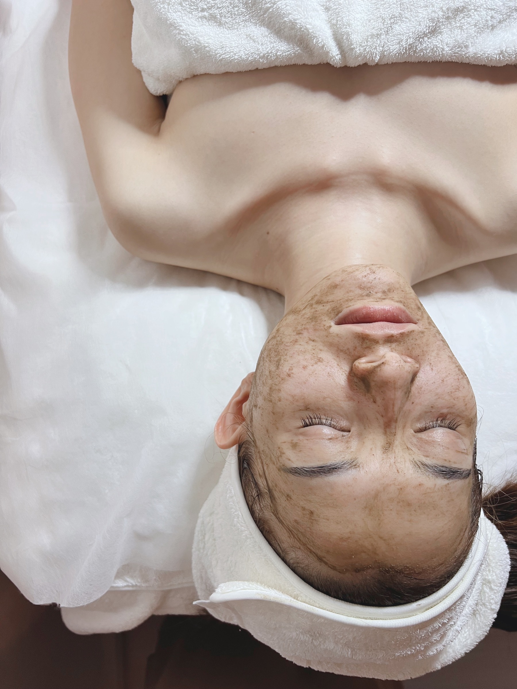 Overhead view of a Peelgae treatment