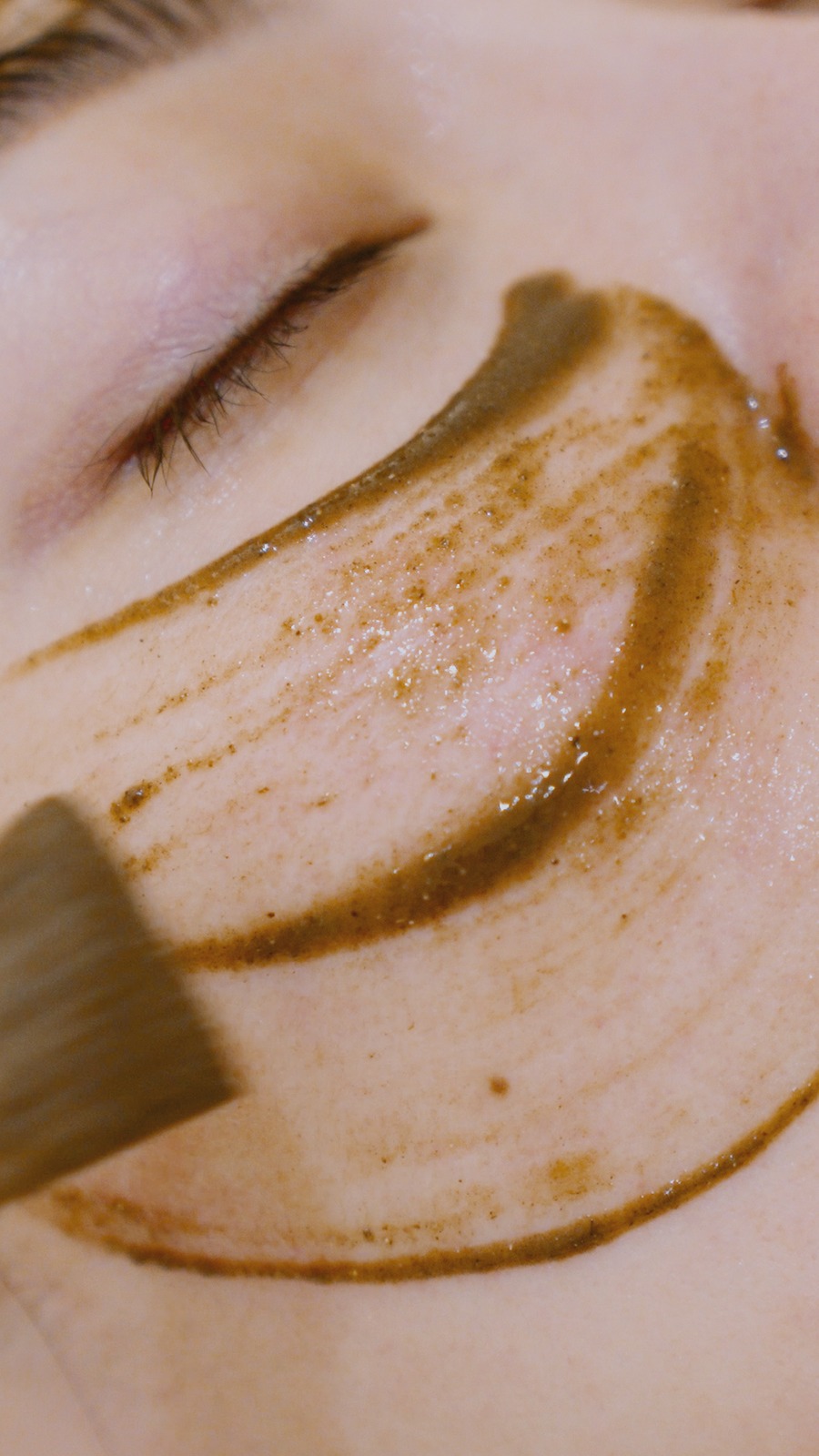 Skin renewal treatment